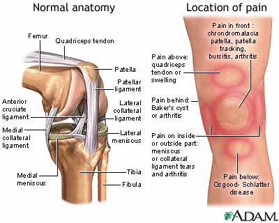 knee pain kneecap