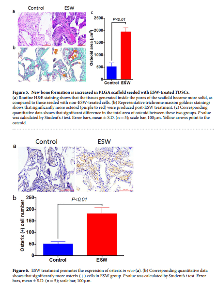  folk focus shockwave promotes the bone marrow stem cells